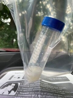 Bagged vial with saliva for Covid19 test
